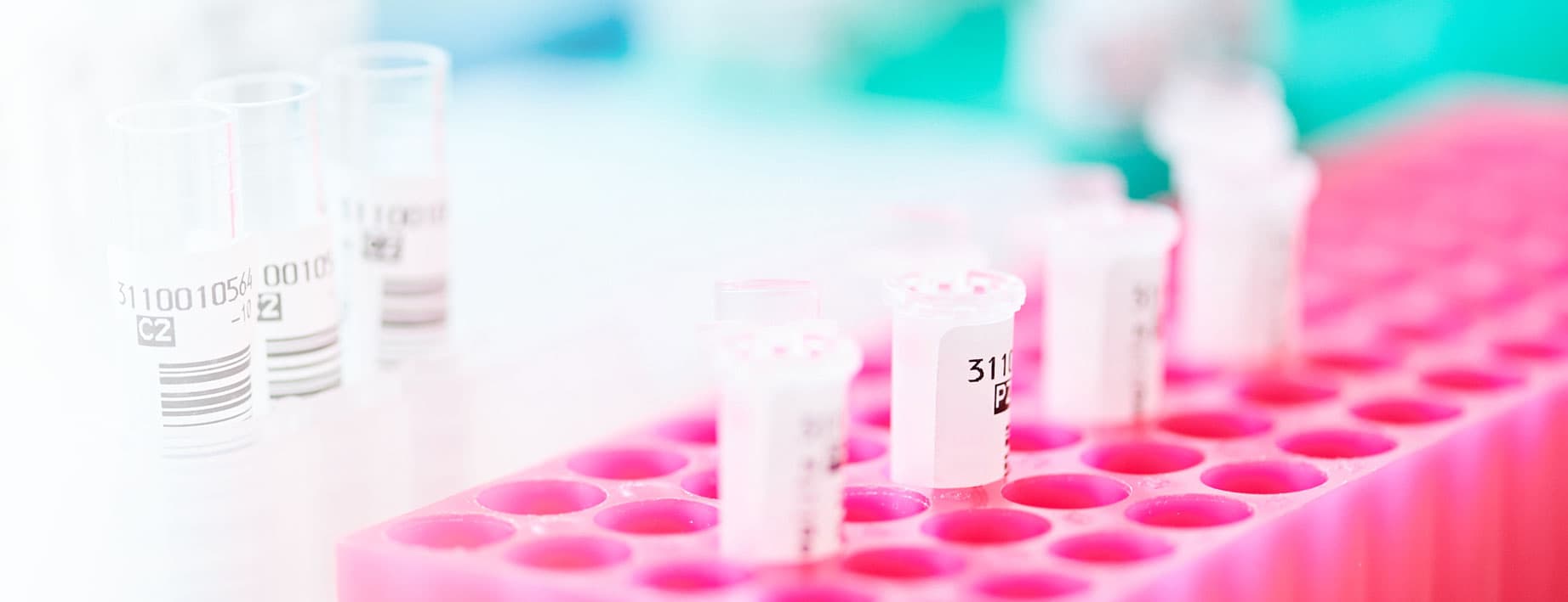 Beschriftete Probenröhrchen in einer pinken Laborhalterung im medizinischen Diagnostiklabor.